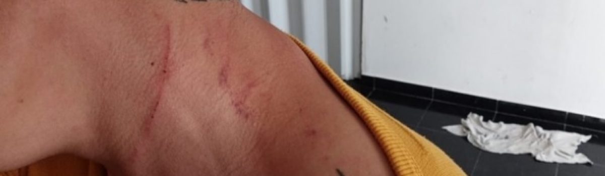 Hombre golpeado