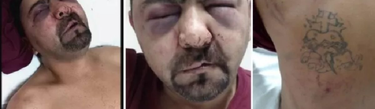 Hombre golpeado por polis en Pto deseado 2022