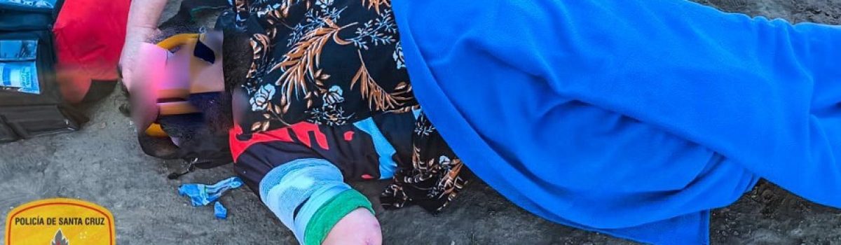 dislocacion de un brazo