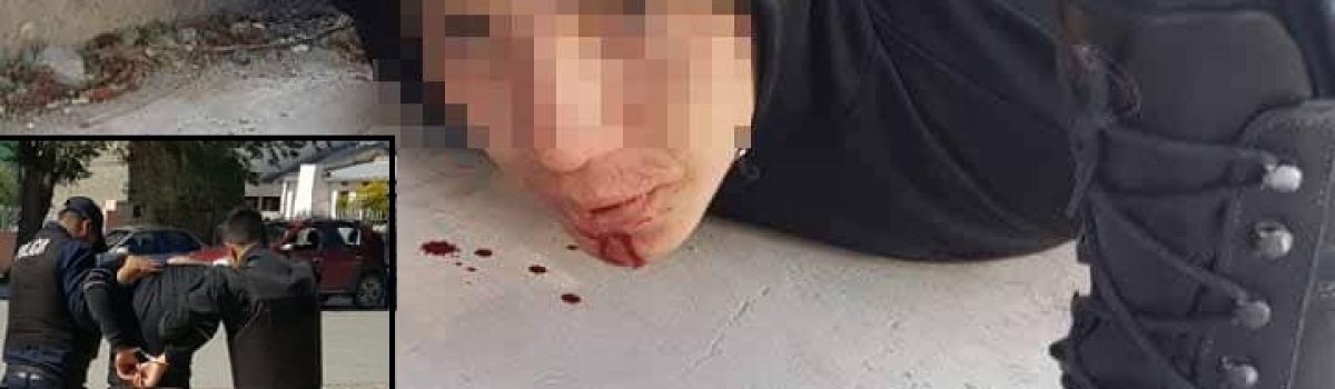 ladron golpeado epp53 1