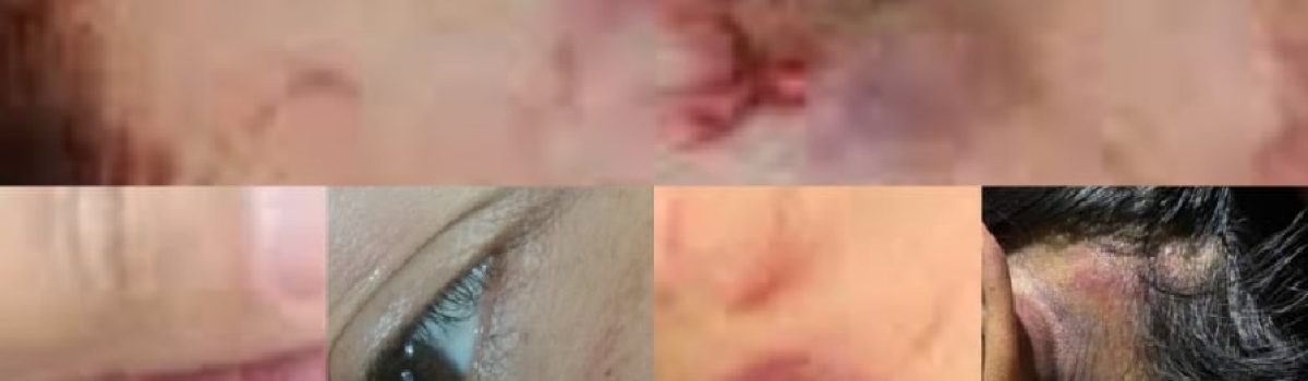 mujer golpeada
