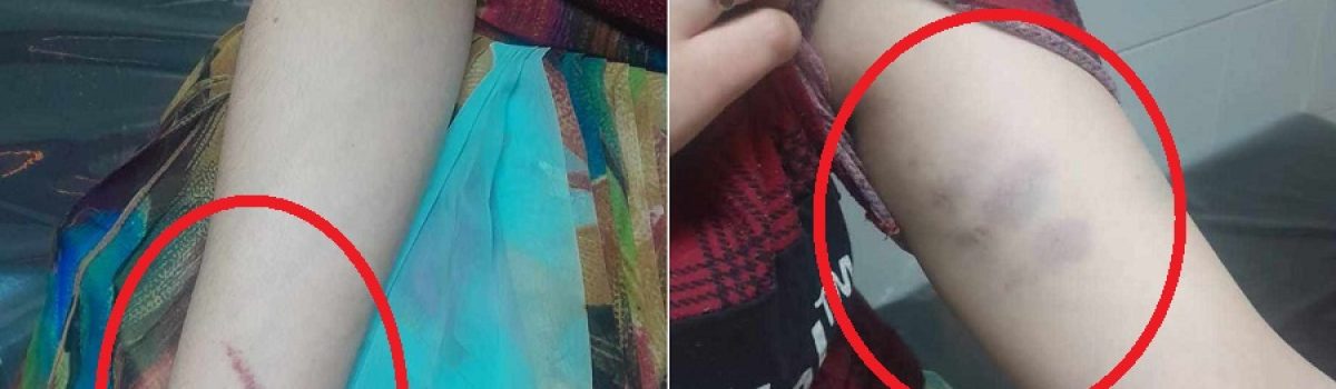 mujer golpeada por gitano