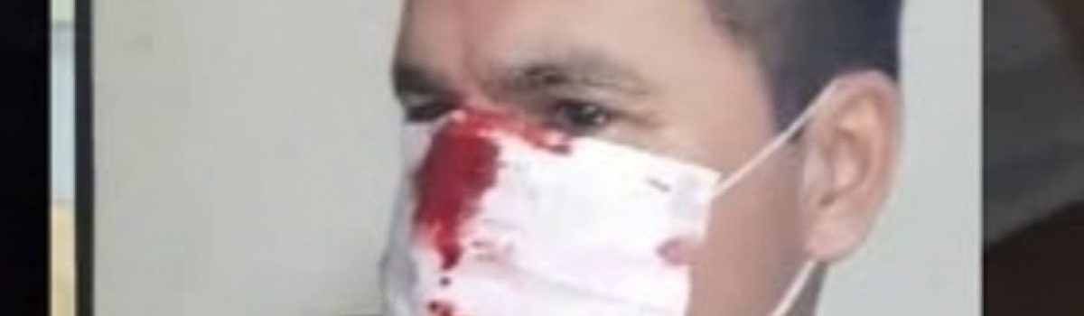 policia golpeado Av Pm 1500